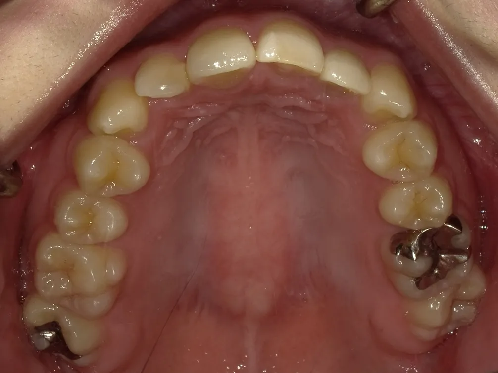 CASE02