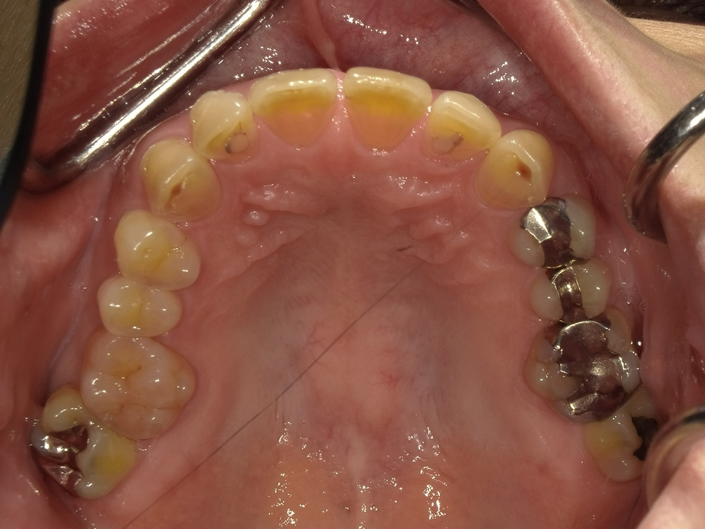 CASE20
