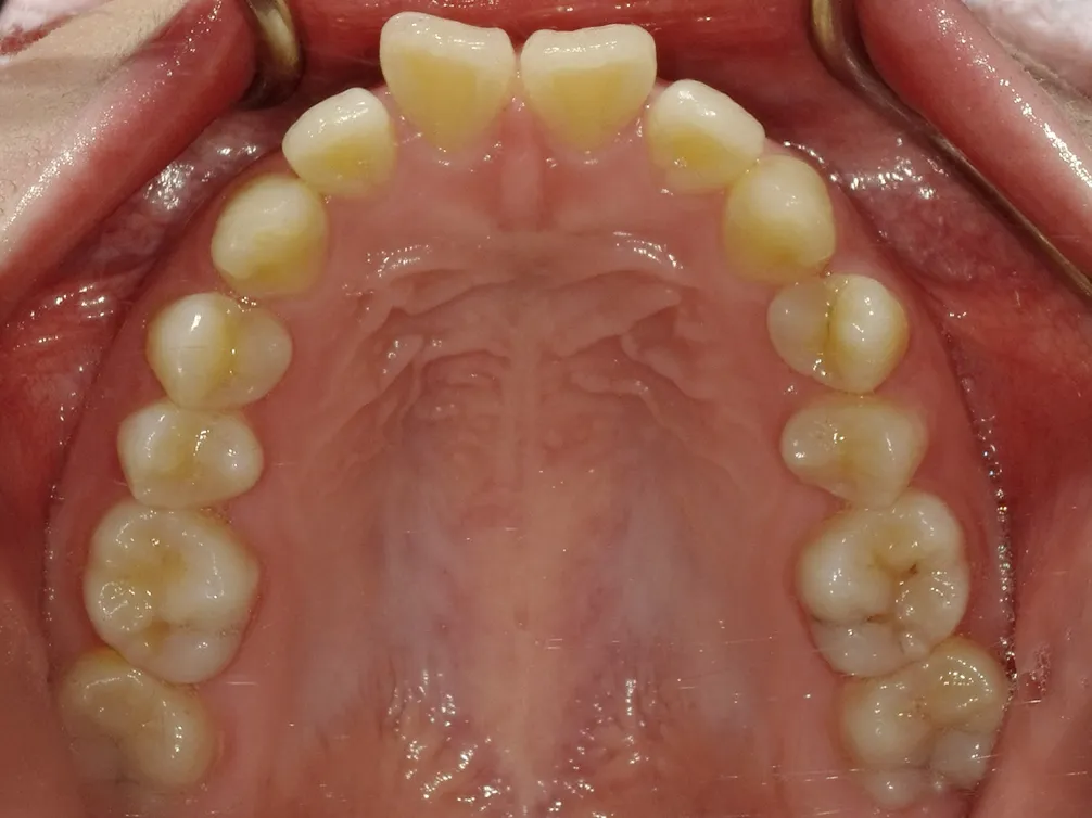 CASE6