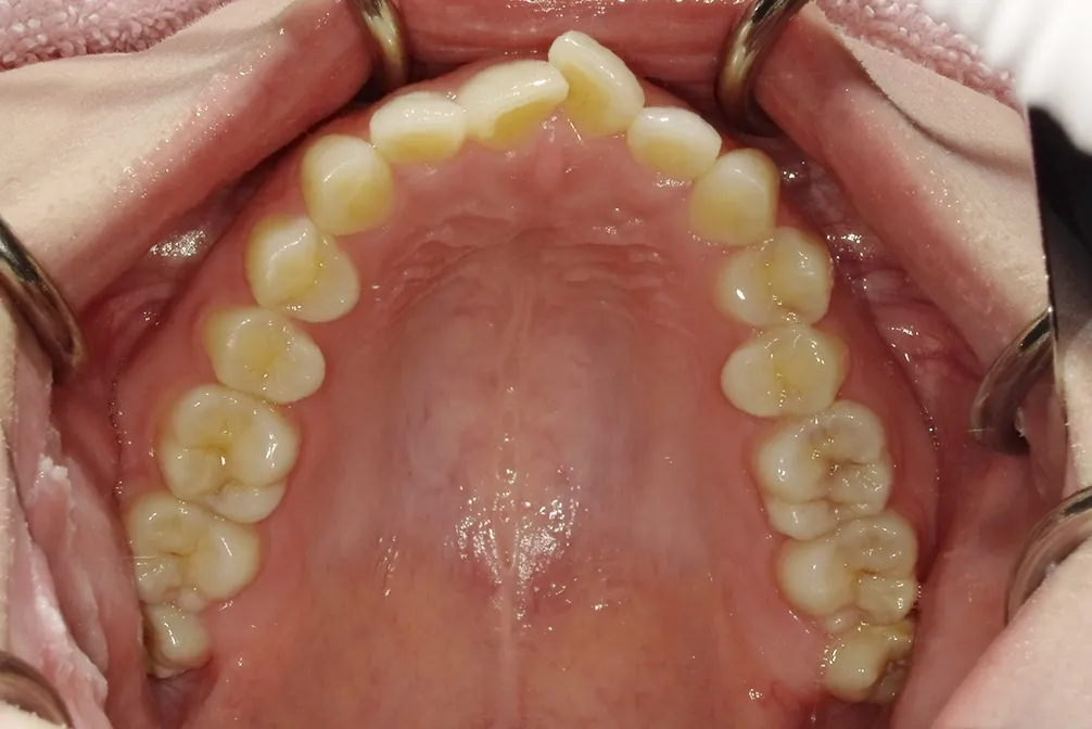 CASE26