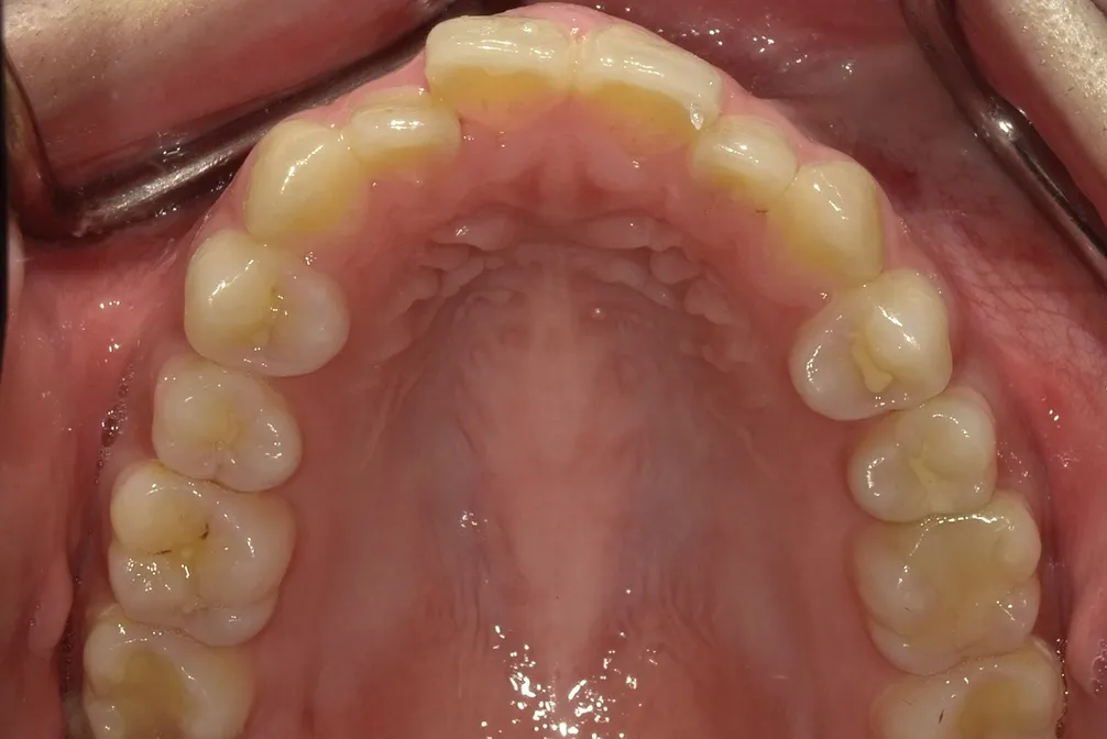 CASE27