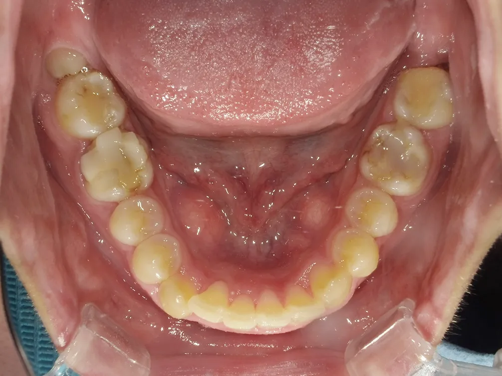CASE5