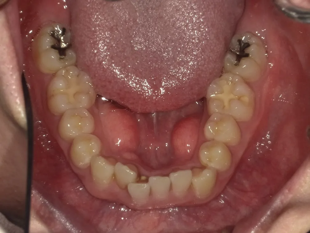 CASE28