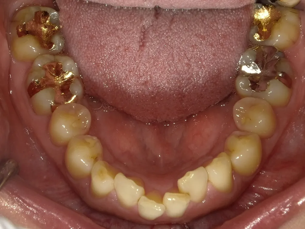 CASE16