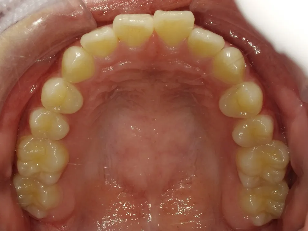 CASE4