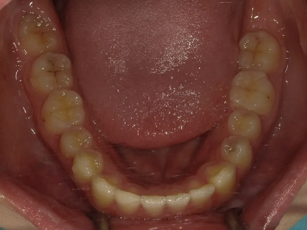 CASE19