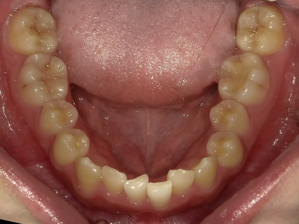 CASE02