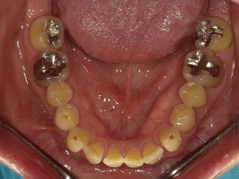 CASE20