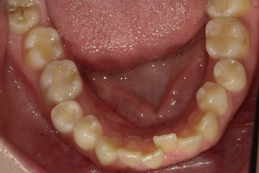 CASE27