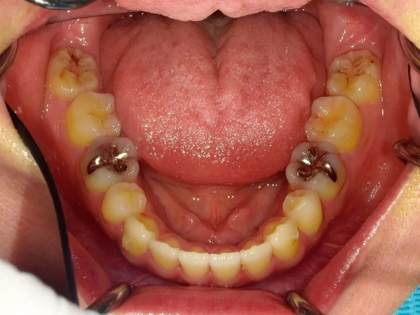CASE16