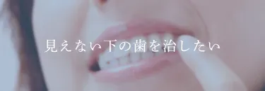 見えない下の歯を治したい