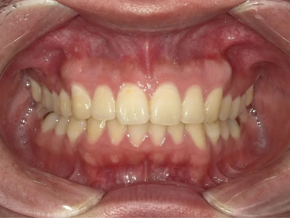 CASE29