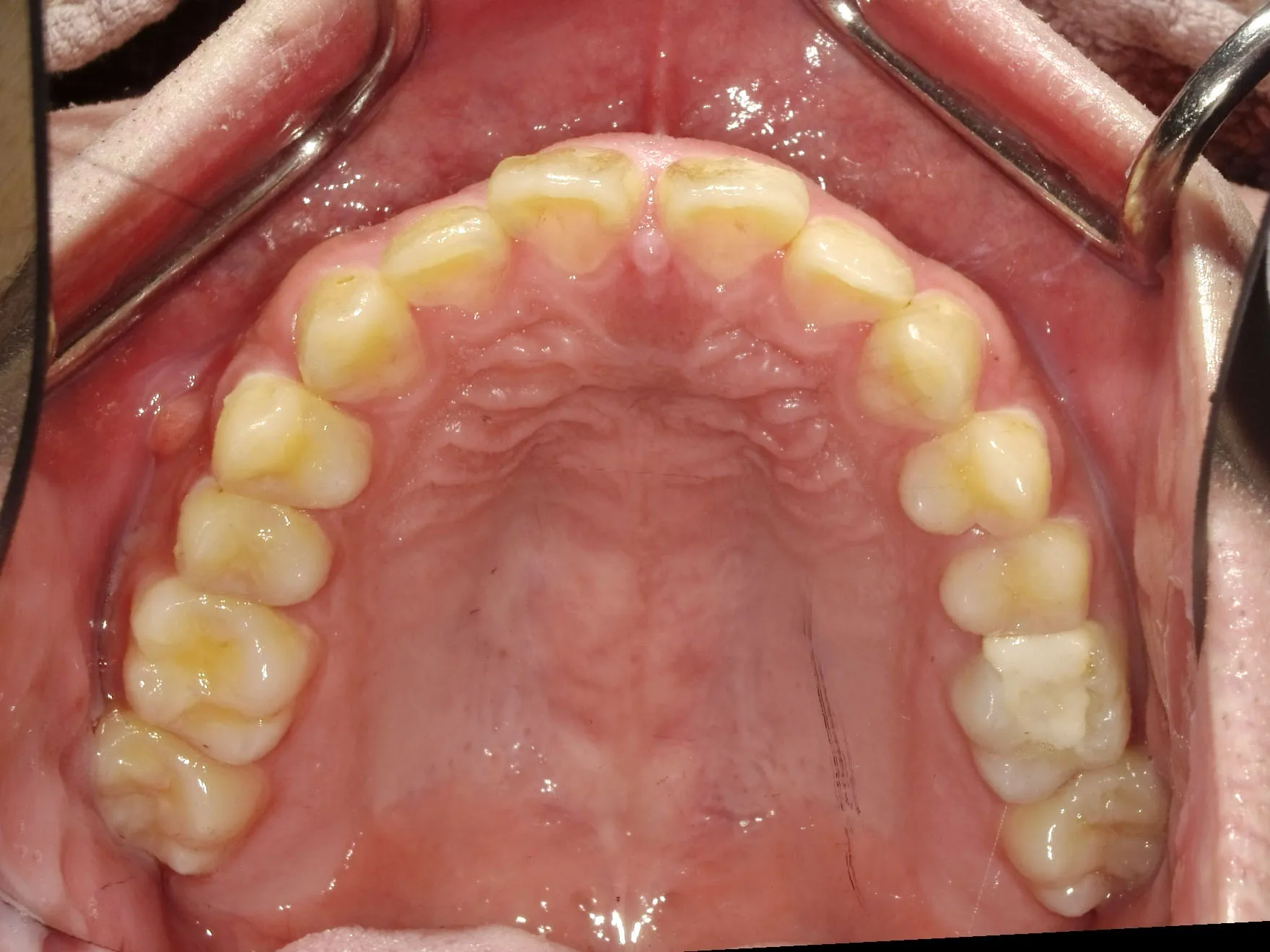 CASE10