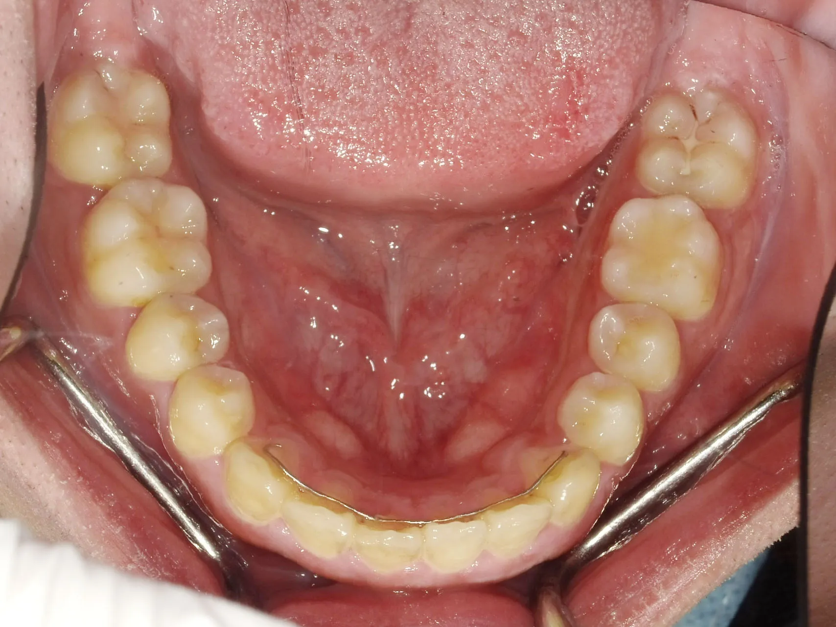CASE10