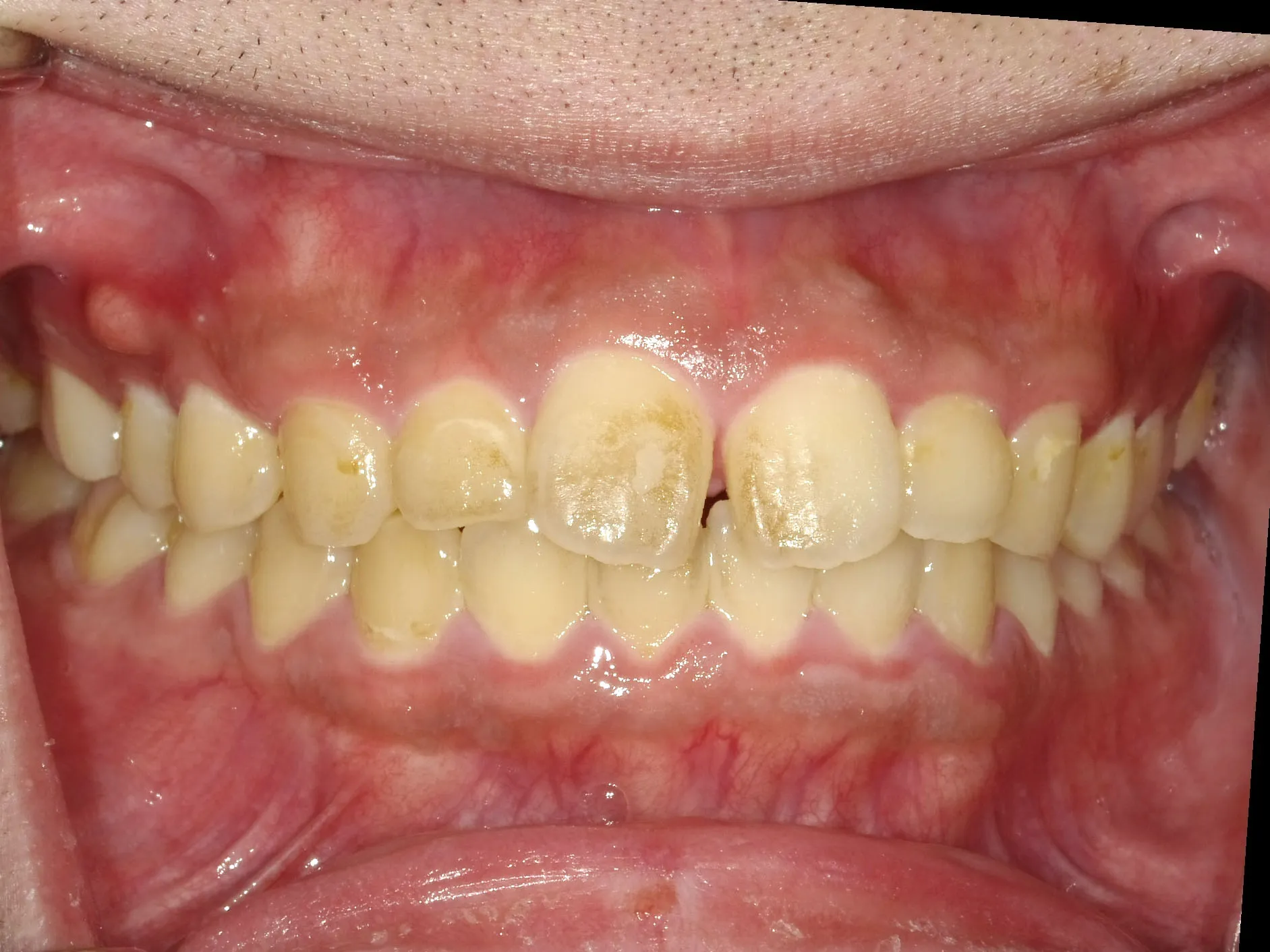 CASE10