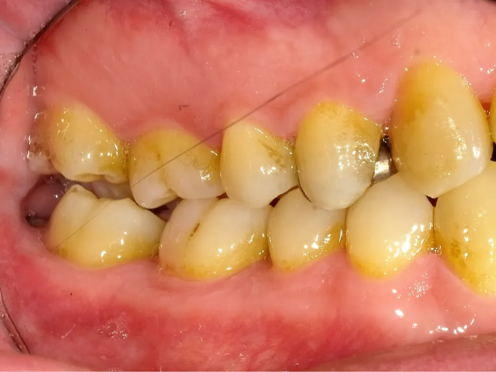 CASE08