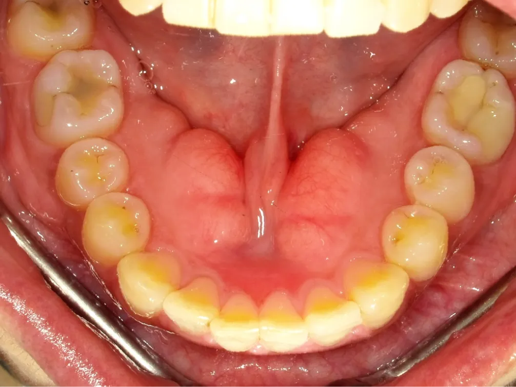 CASE09