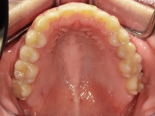 CASE04