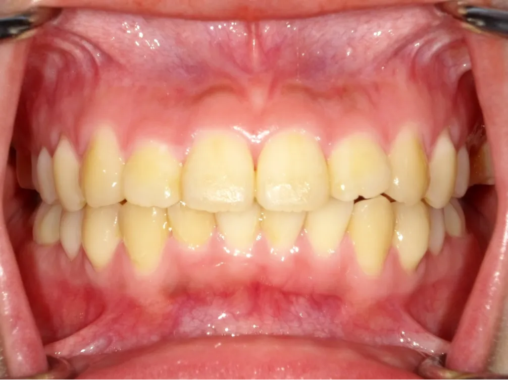 CASE10