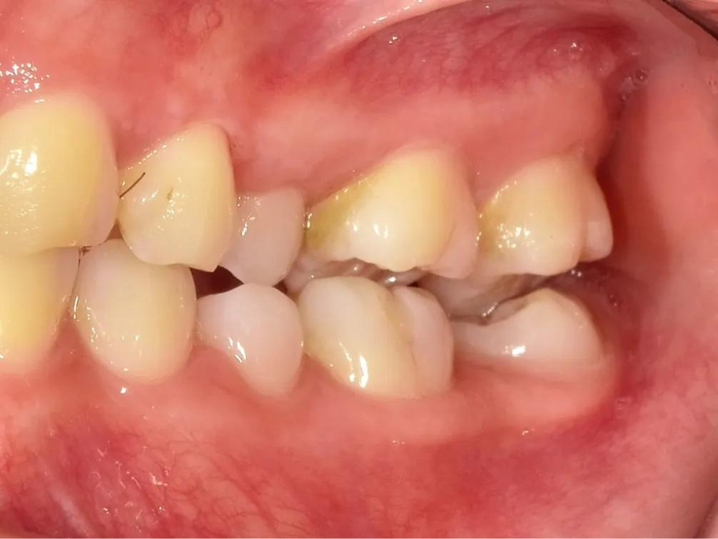 CASE06