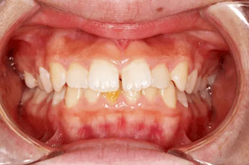 CASE01