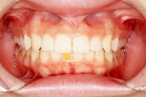 CASE01