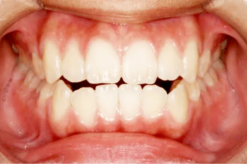 CASE03