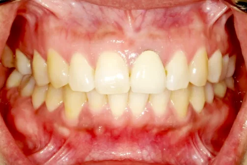 CASE04