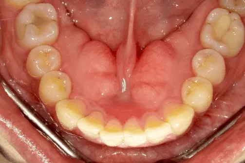 CASE04