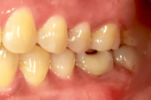 CASE04