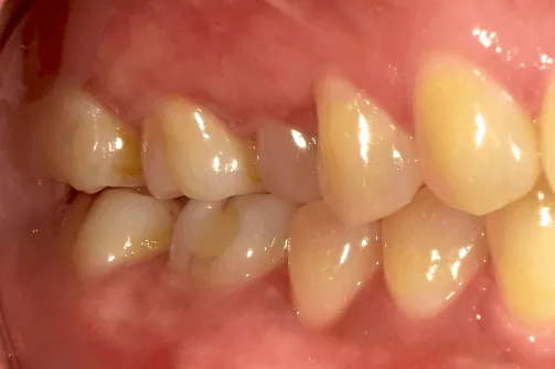 CASE04
