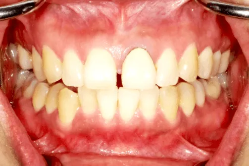CASE04