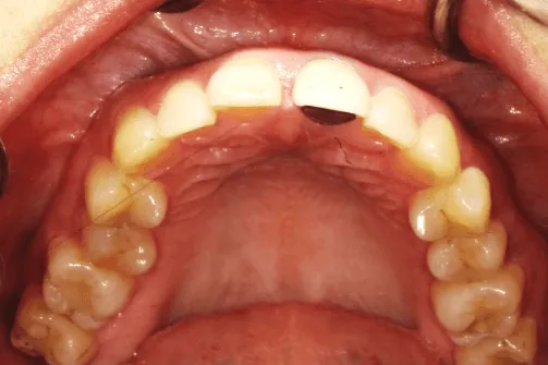 CASE04