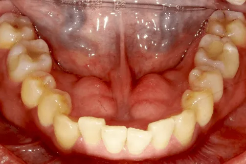 CASE04