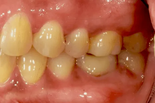 CASE04