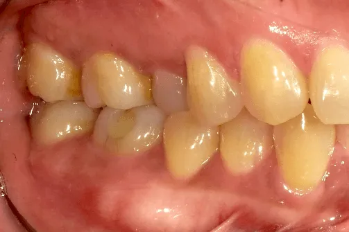 CASE04