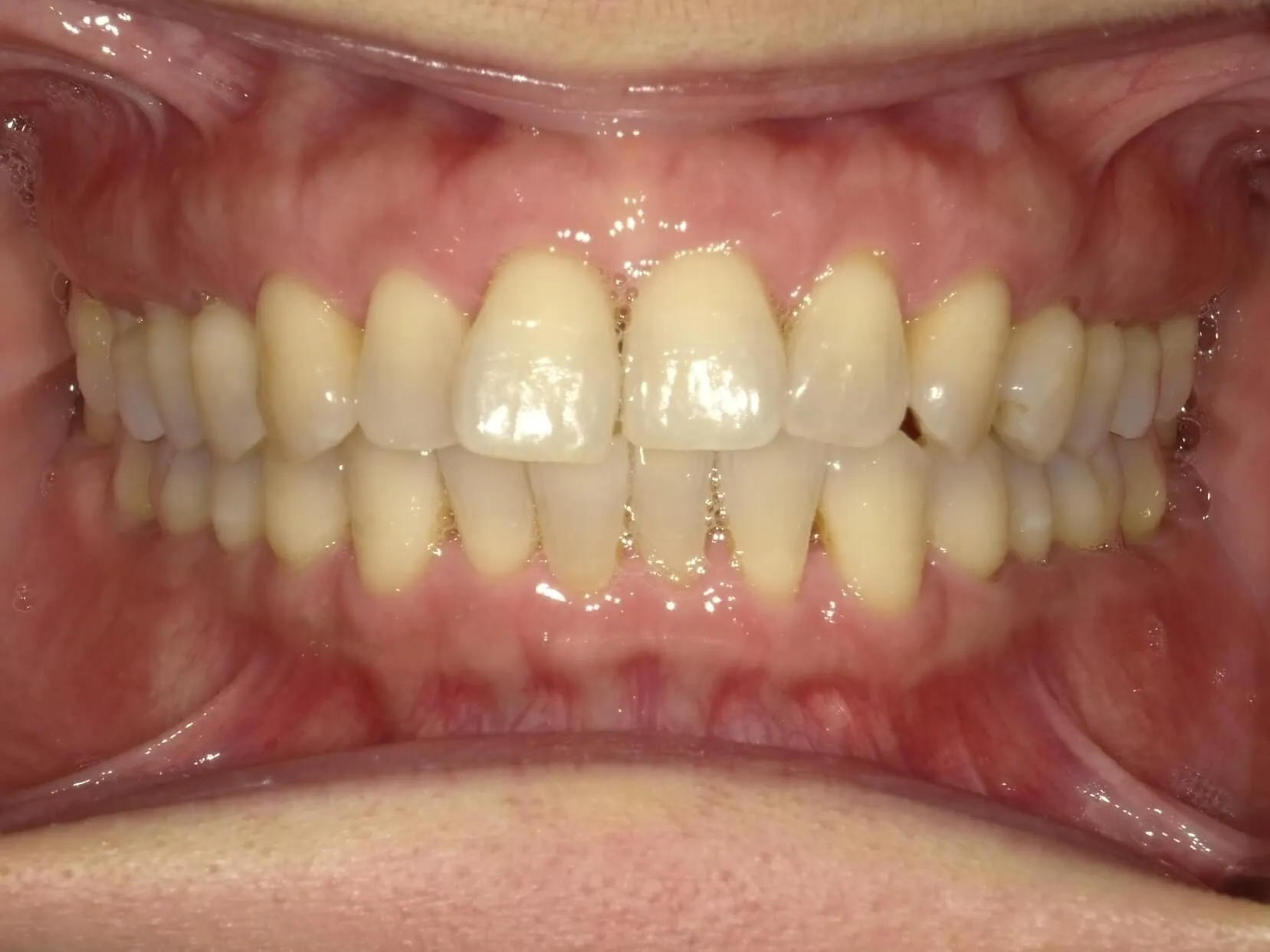 CASE20