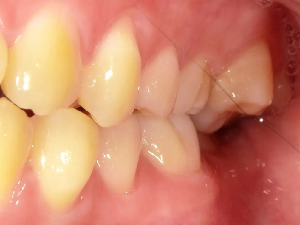 CASE10