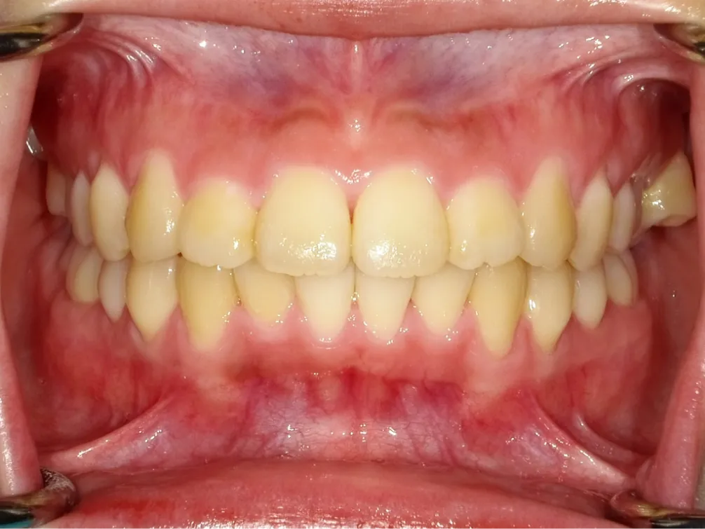 CASE10