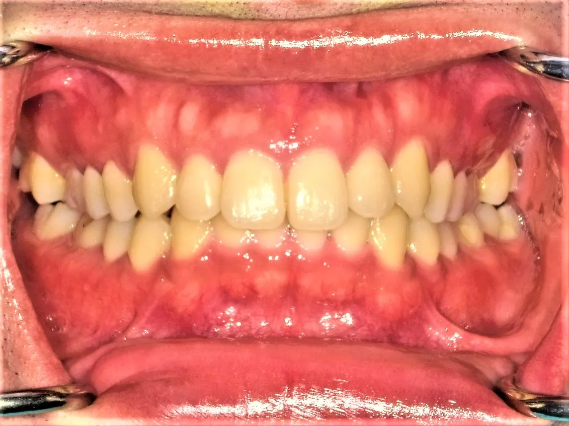 CASE19
