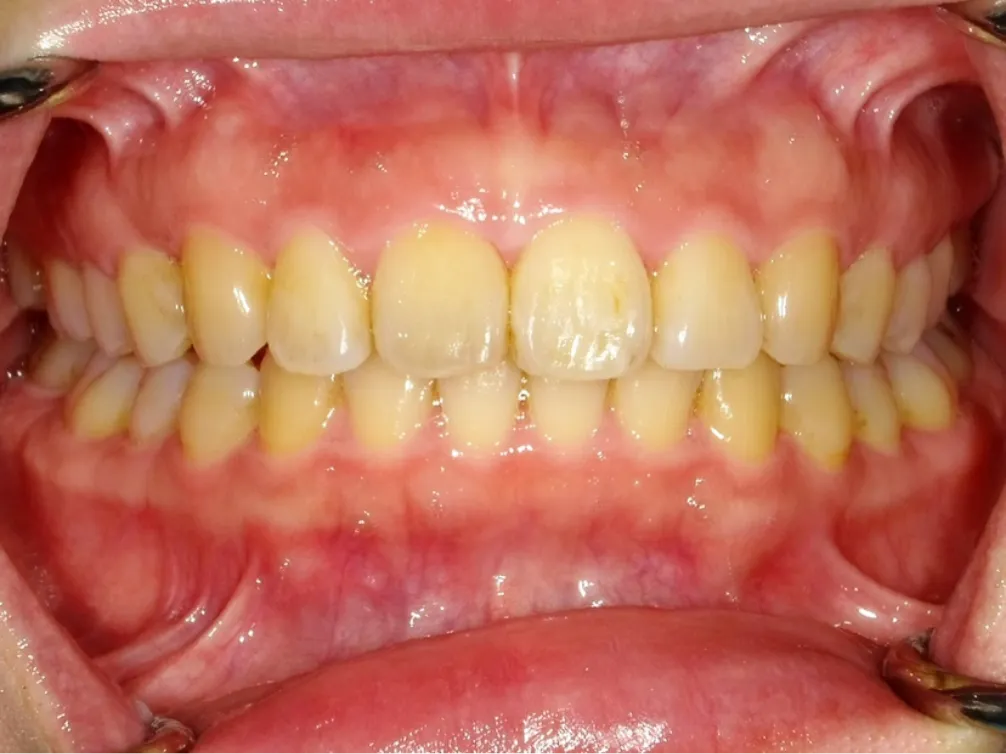 CASE07