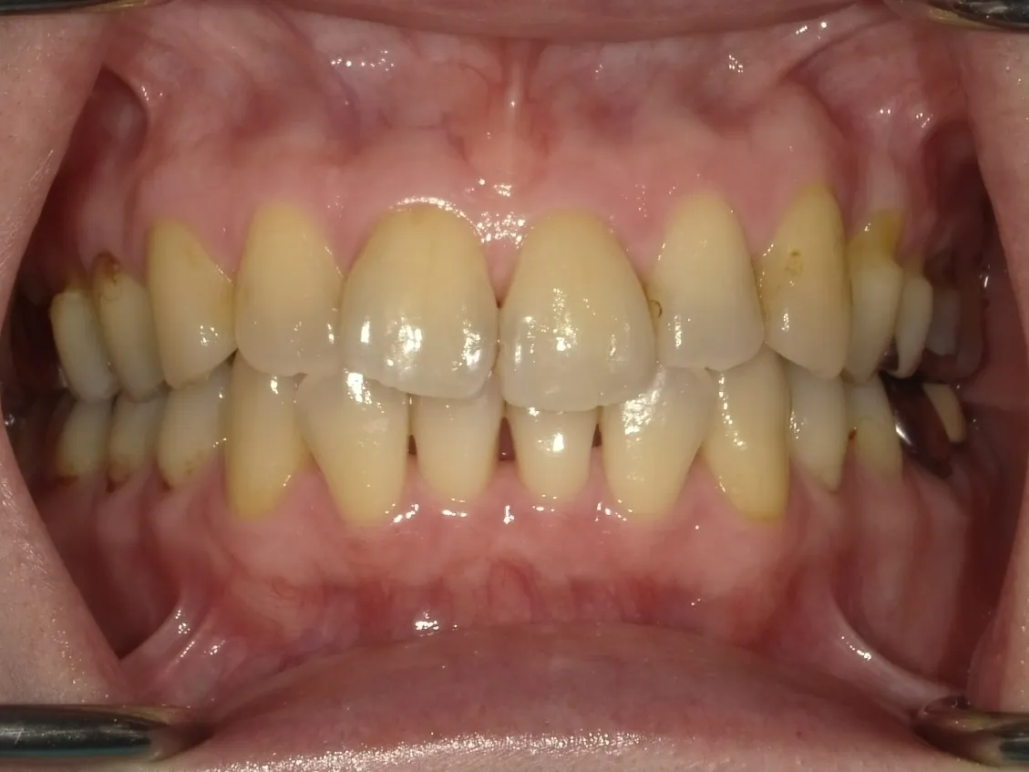 CASE12