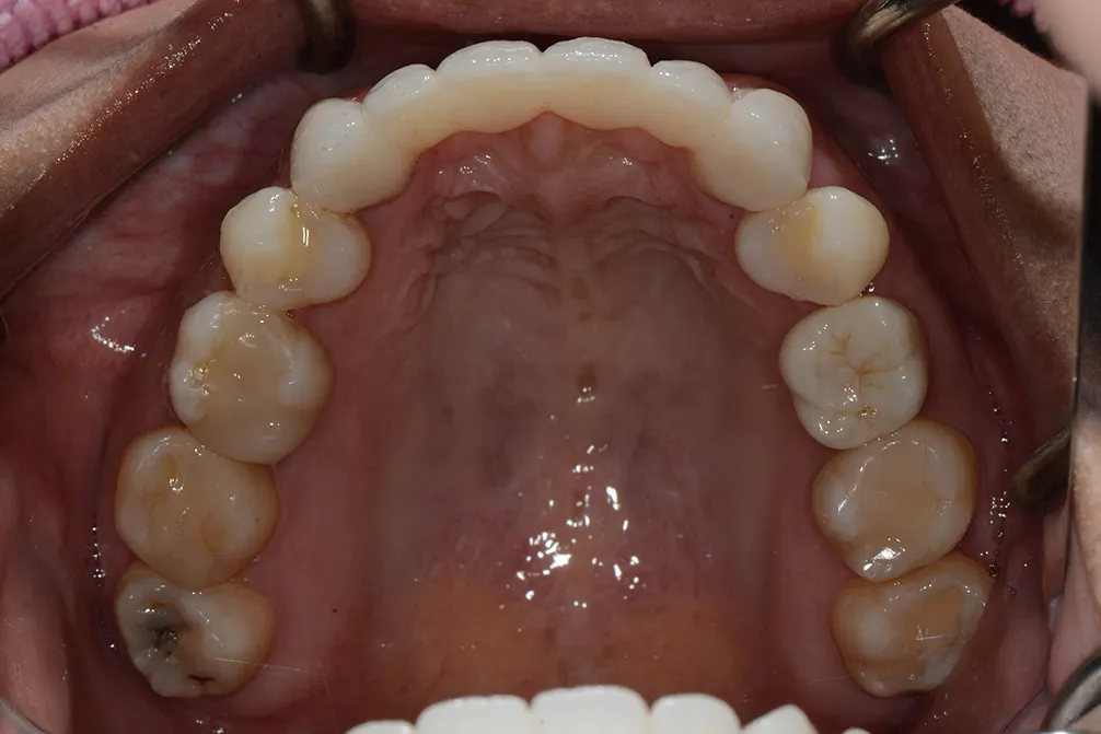 CASE18