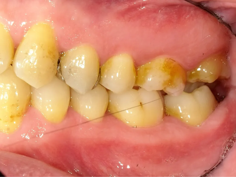 CASE08