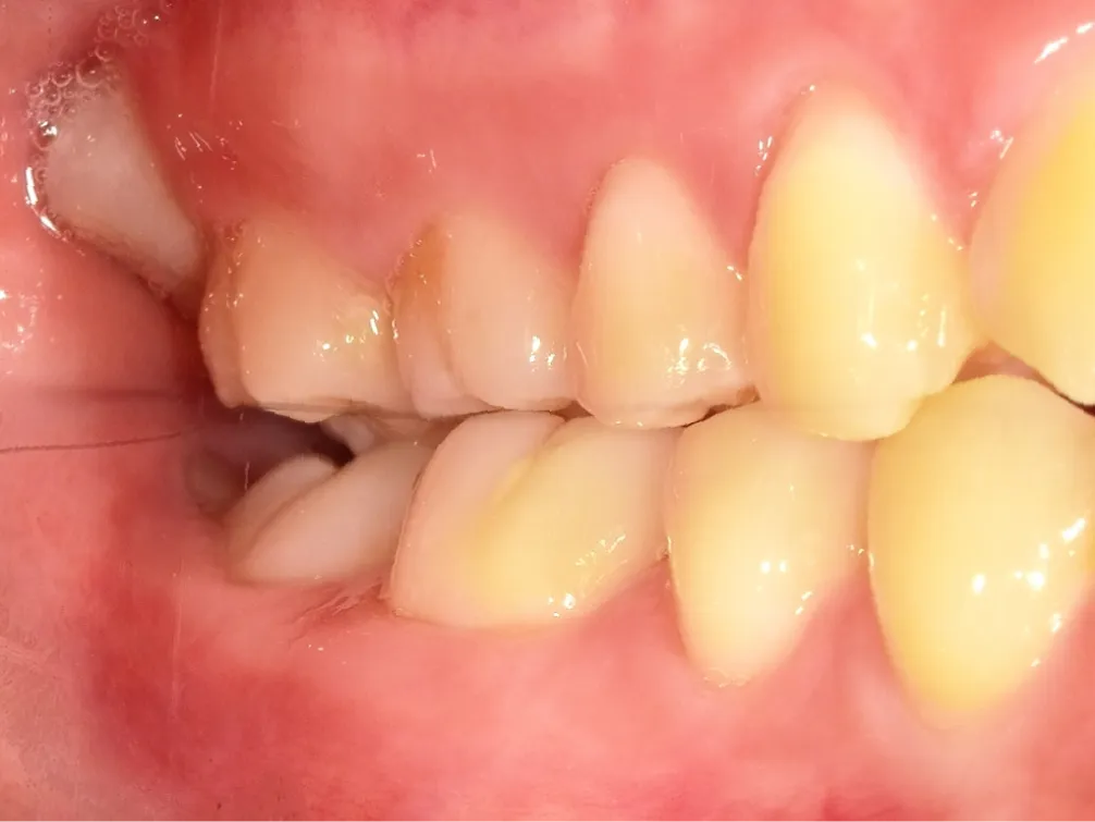 CASE10