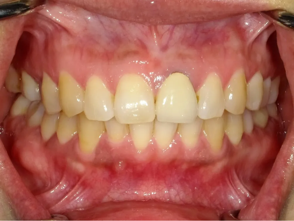 CASE09