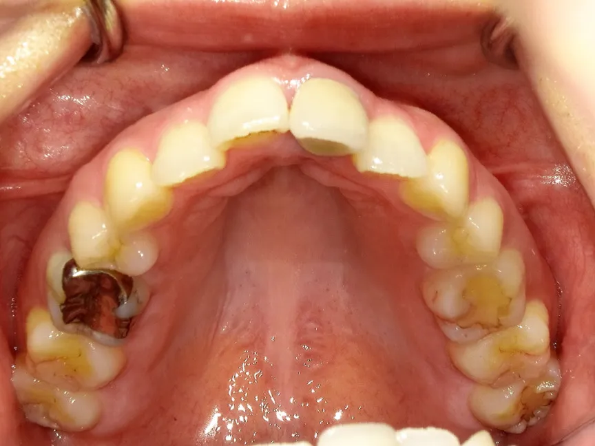 CASE16