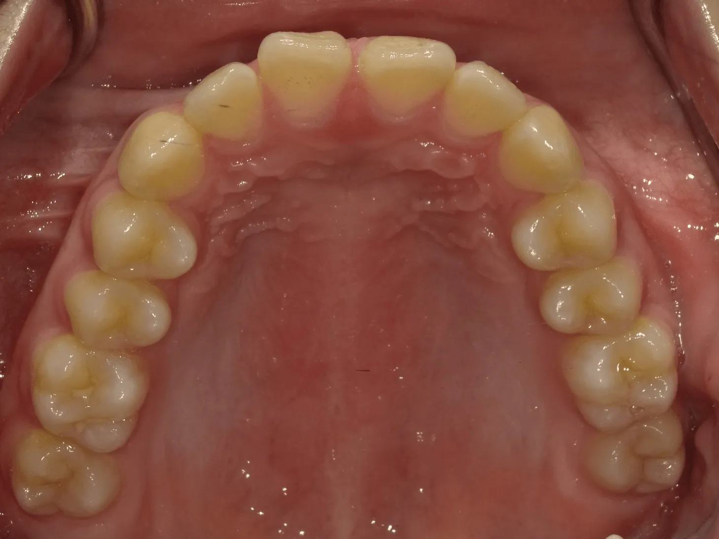 CASE12
