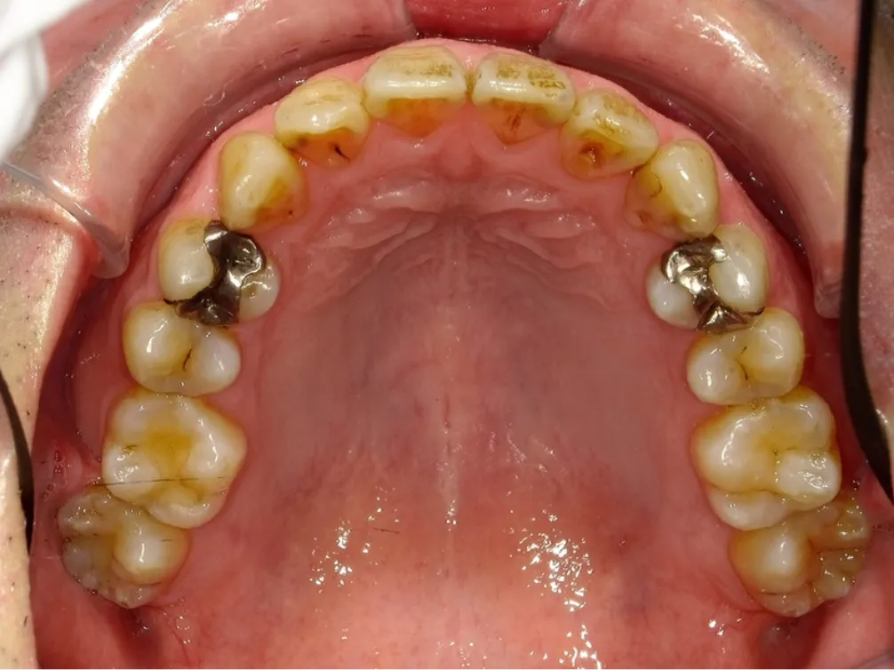 CASE08