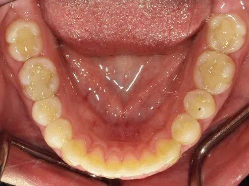 CASE04